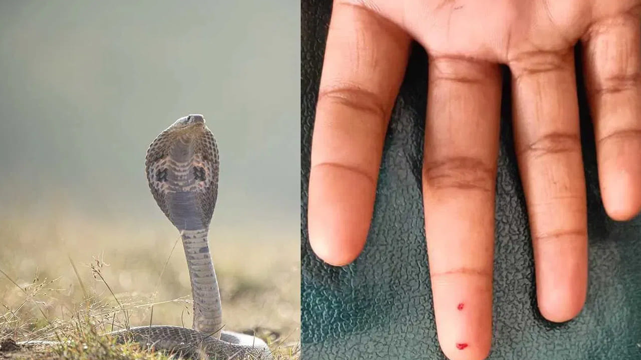 పాత పద్ధతులను నమ్మకండి: సినిమాల్లో చూపించినట్లు గాయాన్ని బ్లేడుతో కోయడం, రక్తాన్ని నోటితో పీల్చడం, లేదా నిప్పుతో కాల్చడం వంటి పనులు అస్సలు చేయకూడదు. దీనివల్ల ఇన్ఫెక్షన్ తీవ్రమవడమే కాకుండా రక్తం ఎక్కువగా గడ్డకట్టే ప్రమాదం ఉంది. అలాగే ఆభరణాలు (ఉంగరాలు, గాజులు) గట్టి చెప్పులను వెంటనే తొలగించాలి, ఎందుకంటే కాటు వేసిన చోట వాపు వచ్చే అవకాశం ఉంది.