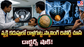 వ్యక్తి కడుపులో రాళ్లగుట్ట..స్కానింగ్‌ రిపోర్ట్‌ చూసి షాక్‌!