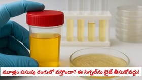 మూత్రం పసుపు రంగులో వస్తోందా? ఈ సిగ్నల్‌ను లైట్ తీసుకోవద్దు!