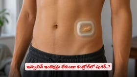 ఇన్సులిన్ ఇంజెక్షన్లు లేకుండా కంట్రోల్‌లో షుగర్..?
