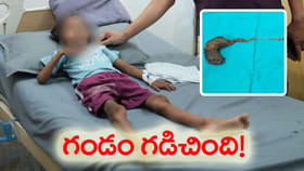 ఏడేళ్ల చిన్నారికి సర్జరీతో ప్రాణం పోసిన డాక్టర్లు..!