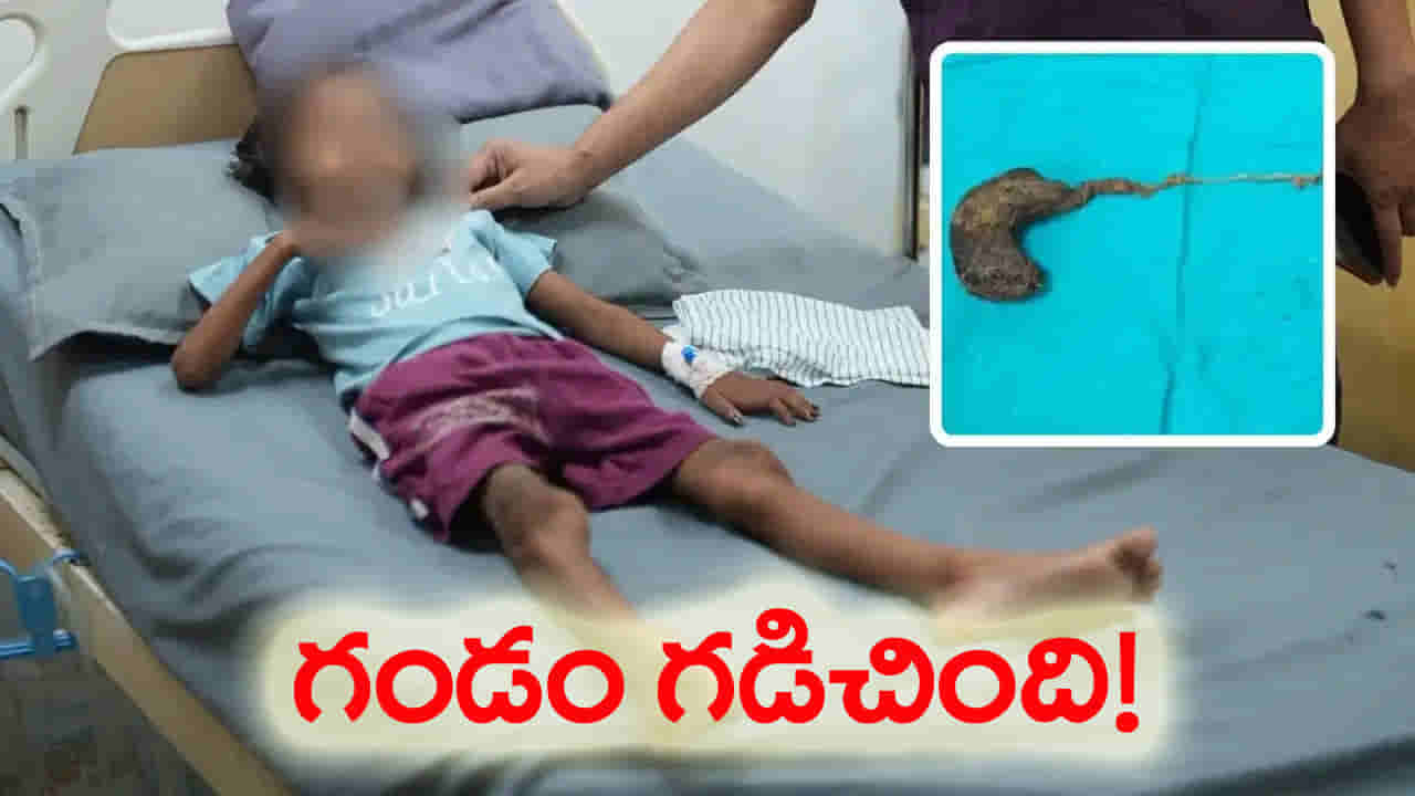 కడుపునొప్పితో ఆసుపత్రికి ఏడేళ్ల బాలిక.. స్కాన్ చేసి చూసిన డాక్టర్లు షాక్..!