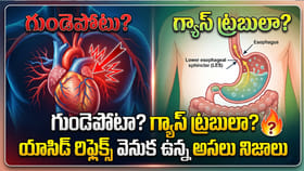 గుండెపోటా? గ్యాస్ ట్రబులా? యాసిడ్ రిఫ్లెక్స్ వెనుక ఉన్న నిజాలు