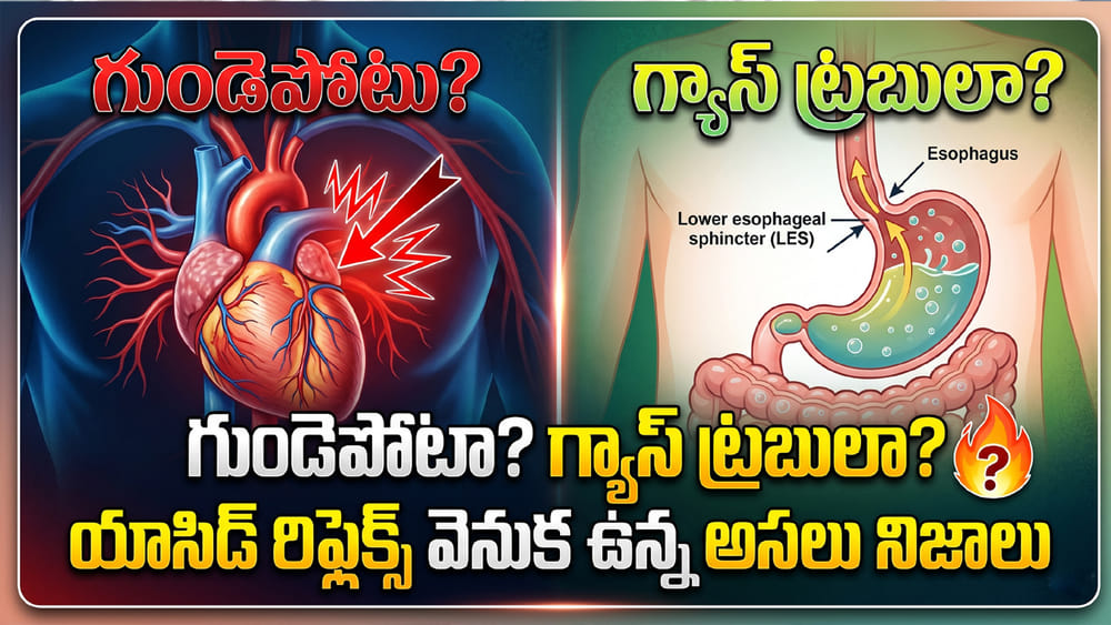 Gas-Problem: గుండెపోటా? గ్యాస్ ట్రబులా? యాసిడ్ రిఫ్లెక్స్ వెనుక ఉన్న అసలు నిజాలు