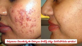 నిపుణులు చెబుతున్న ఈ చిట్కాలు పాటిస్తే చర్మం మెరిసిపోవడం ఖాయం!