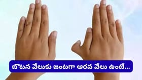 చేతిలో అదనపు వేలు ఉంటే అదృష్టం కలిసొస్తుందా? ఆశ్చర్యపరిచే..