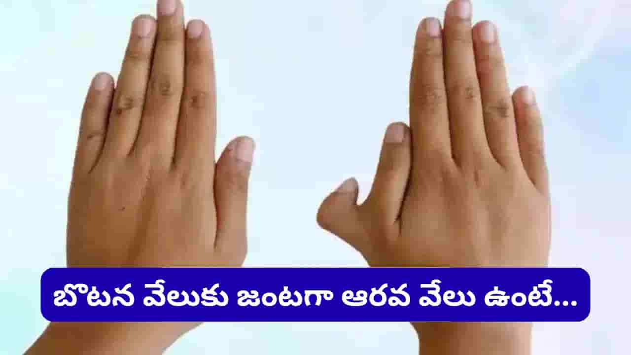 Polydactyly Facts: హస్తసాముద్రిక శాస్త్రం.. చేతిలో ఆరవ వేలు ఉంటే అదృష్టమా? వ్యక్తిత్వంపై దాని ప్రభావం ఏమిటి?