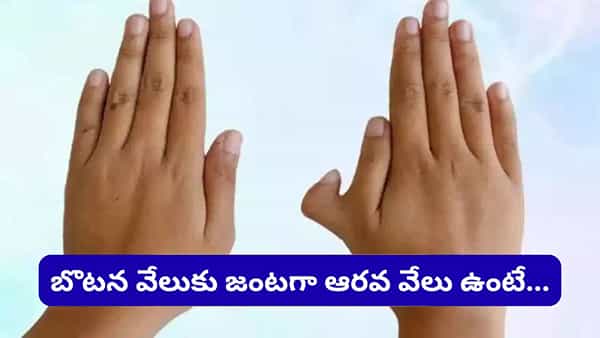 Polydactyly Facts: హస్తసాముద్రిక శాస్త్రం.. చేతిలో ఆరవ వేలు ఉంటే అదృష్టమా? వ్యక్తిత్వంపై దాని ప్రభావం ఏమిటి?