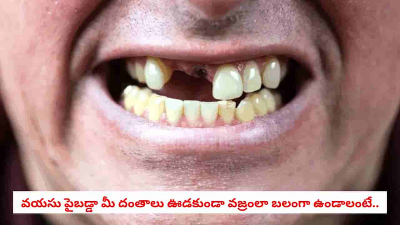Dental Care: వృద్ధాప్యంలో దంతాలు ఎందుకు ఊడిపోతాయో తెలుసా? వైద్యులు చెబుతున్న అసలు కారణాలు ఇవే!