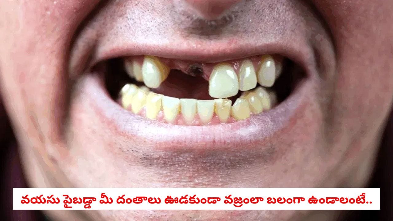 Dental Care: వృద్ధాప్యంలో దంతాలు ఎందుకు ఊడిపోతాయో తెలుసా? వైద్యులు చెబుతున్న అసలు కారణాలు ఇవే!