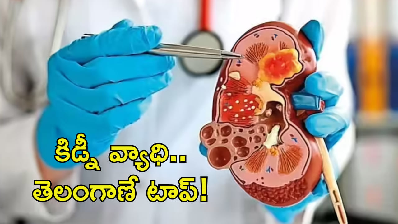 కిడ్నీ వ్యాధి మరణాల్లో తెలంగాణనే టాప్! బాధితుల సంఖ్య పెరగడానికి కారణాలు ఇవే