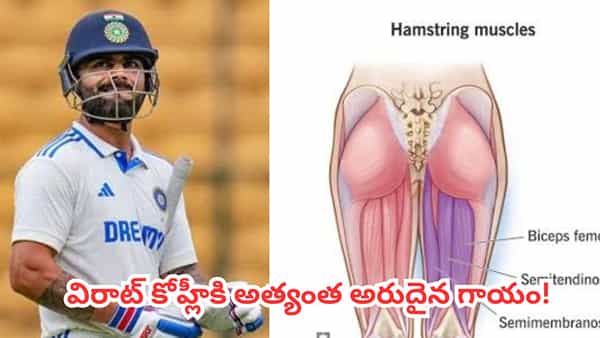 Virat Kohli : సాధారణ గాయం కాదు.. స్కానింగ్ రిపోర్టులో అసలు నిజం.. మళ్లీ కోహ్లీ బ్యాట్ పట్టాలంటే ఎన్ని రోజులు పడుతుందో ?