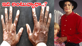 చేపలు తిన్న వెంటనే పాలు తాగితే ఈ వ్యాధి వస్తుందా?