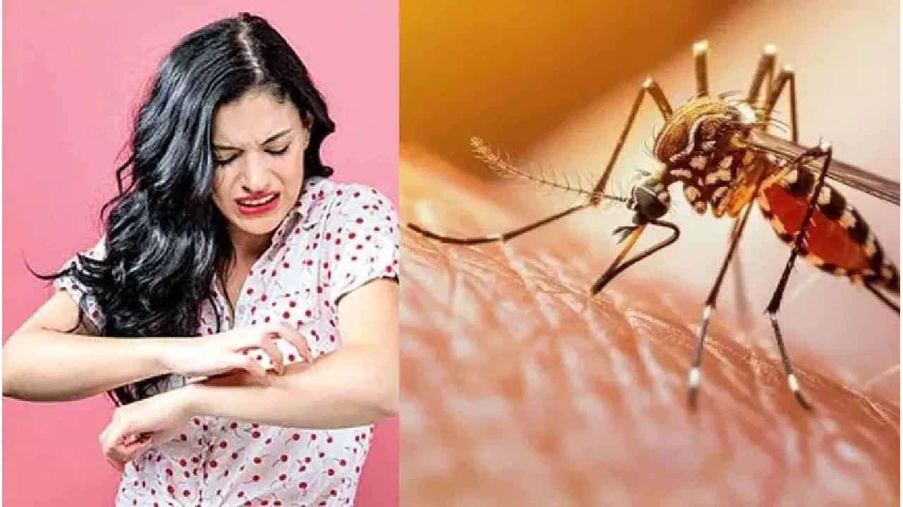 శరీర వేడి - చెమట: దోమలకు వెచ్చదనం, తేమ అంటే చాలా ఇష్టం. మనుషుల వాసన, CO2 ఆధారంగా మన దగ్గరకు చేరుకునే దోమలు.. ఆ తర్వాత రక్తం తాగడానికి శరీరంలోని అత్యంత వెచ్చని భాగాలను ఎంచుకుంటాయి. అందుకే క్రమం తప్పకుండా వ్యాయామం చేసేవారు, ఎండలో ఎక్కువగా శ్రమించేవారు లేదా విపరీతంగా చెమట పట్టే వారిపై దోమలు ఎక్కువగా దాడి చేస్తాయి. వెచ్చని చర్మం, తేమతో కూడిన చెమట దోమలకు పండగలా మారుతాయి.
