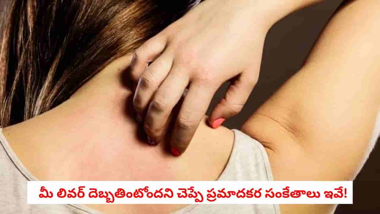 Liver Health: మీ చర్మంపై ఈ మార్పులు కనిపిస్తున్నాయా?.. లివర్ దెబ్బతింటోందని చెప్పే ప్రమాదకర సంకేతాలు ఇవే!
