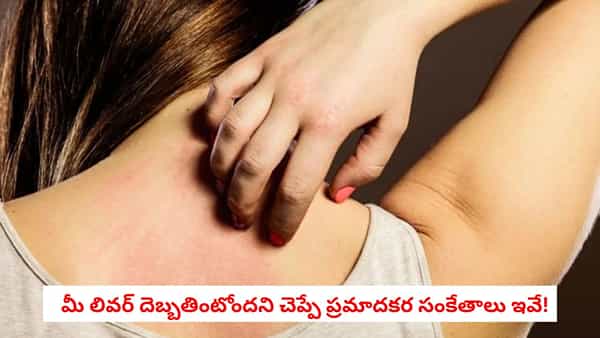 Liver Health: మీ చర్మంపై ఈ మార్పులు కనిపిస్తున్నాయా?.. లివర్ దెబ్బతింటోందని చెప్పే ప్రమాదకర సంకేతాలు ఇవే!