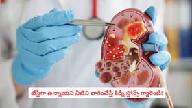 టేస్టీగా ఉన్నాయని వీటిని లాగించేస్తే కిడ్నీ స్టోన్స్ గ్యారెంటీ!