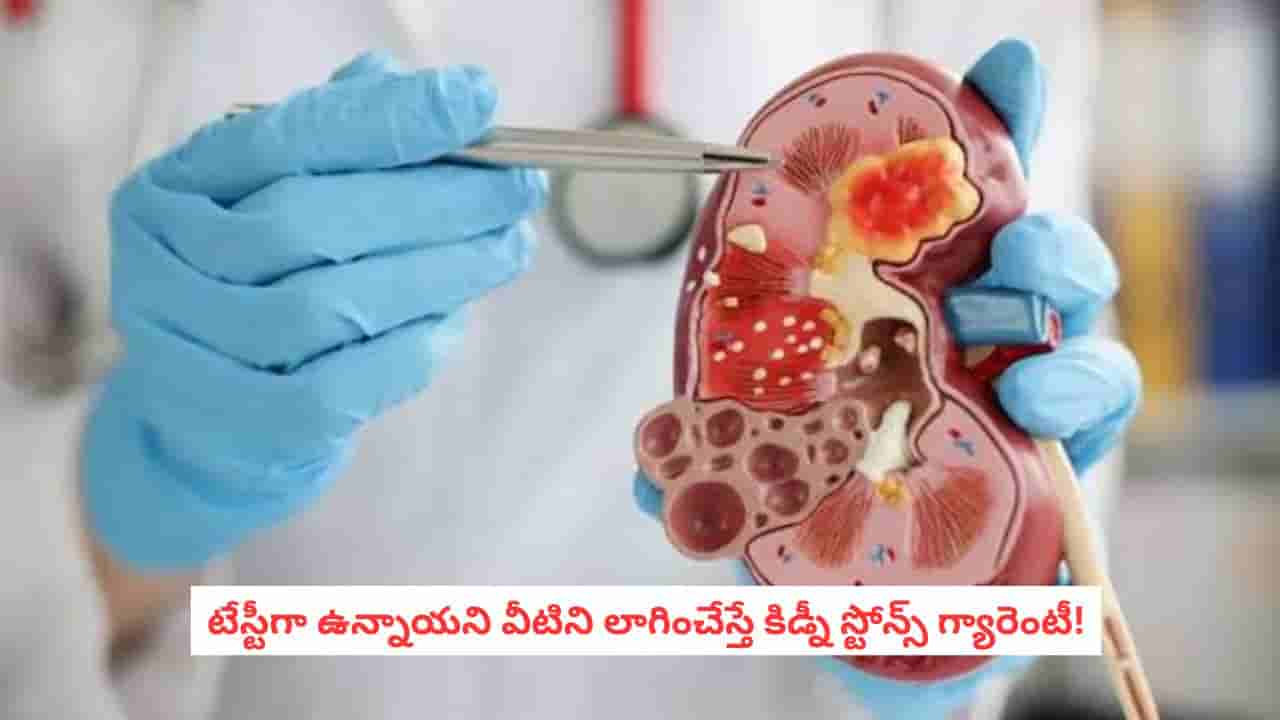 Kidney Health: వంటల్లో వాడే ఆ పదార్థాలతోనే ముప్పు.. అతిగా తింటే మాత్రం కిడ్నీలో రాళ్లు రావడం ఖాయం!