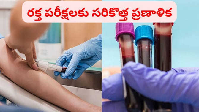 గుడ్ న్యూస్.. ఉచిత టెస్టులకు సరికొత్త ప్రణాళిక