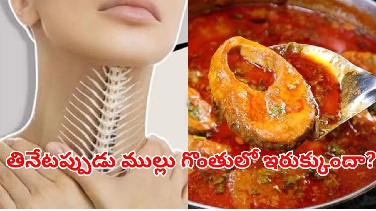 Fish bone: ఆరెరే గొంతులో ఇరుక్కున చేపముల్లు తొలగించడం ఇంత ఈజీనా.. ఇన్నాళ్లు ఈ ట్రిక్ తెలీదే! | How to Get a Fish Bone Out of Your Throat: Easy Home Remedies