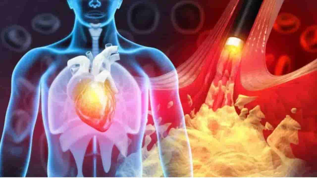 ICMR Study: పదిలో తొమ్మిది మందిని వెంటాడుతున్న డేంజర్ వ్యాధి.. ఐసీఎంఆర్ సర్వేలో షాకింగ్ నిజాలు!