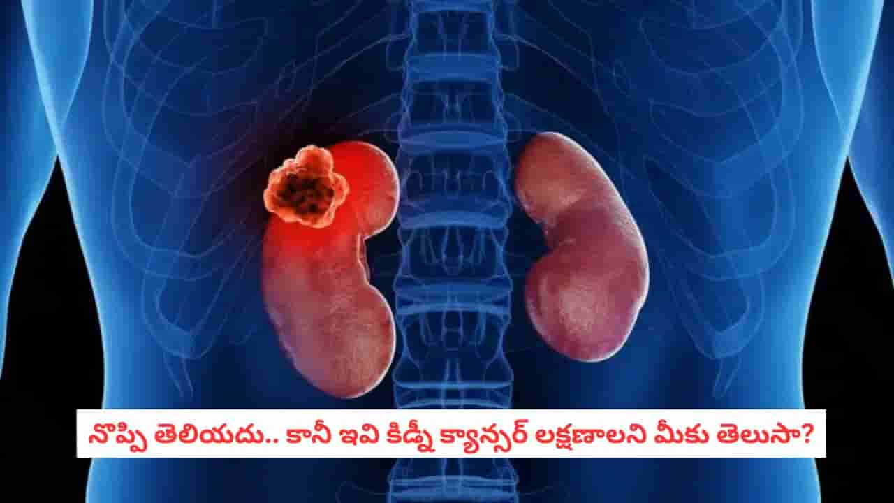 Kidney Cancer: లోపల కిడ్నీ క్యాన్సర్ పెరుగుతున్నా బయటకు తెలీదు.. ఈ లక్షణాలు మొదటి స్టేజీలోనే గుర్తిస్తే ప్రాణాలు సేఫ్!