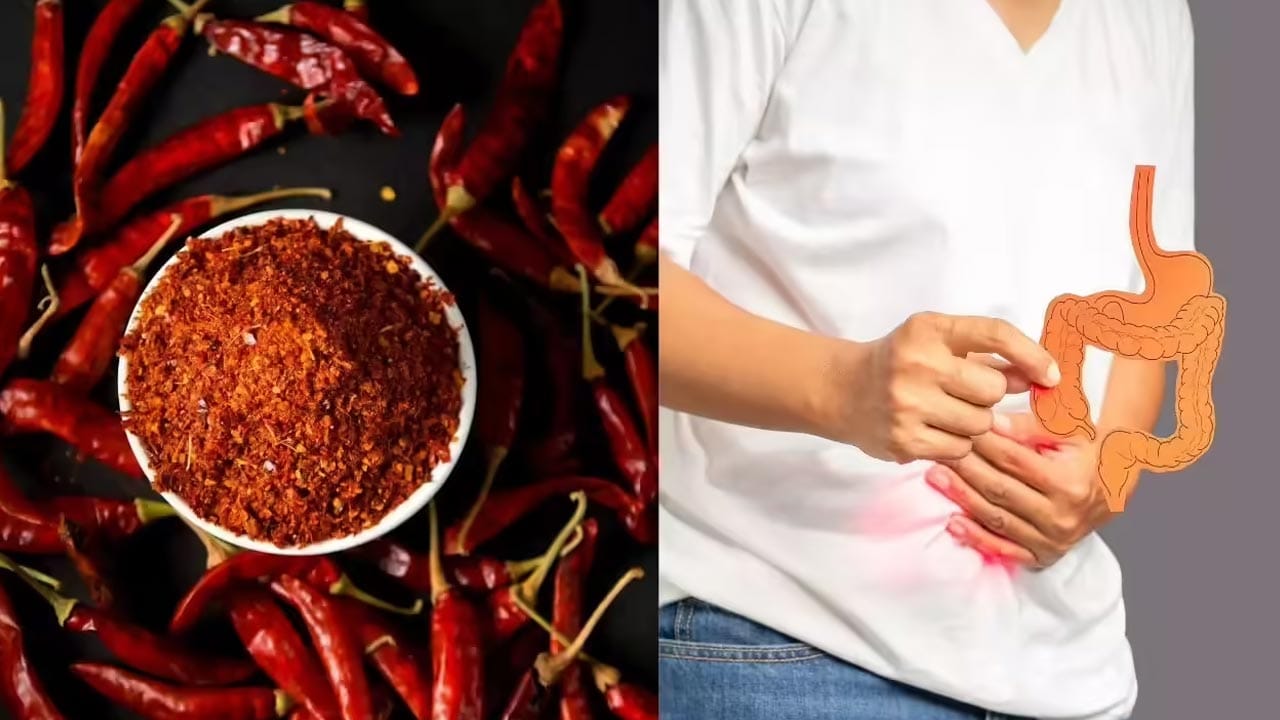 కడుపులో మంట, అసిడిటీ, అల్సర్లు: కారం ఎక్కువైనప్పుడు కడుపులోని పొరలు తీవ్రంగా ప్రభావితమవుతాయి. దీనివల్ల నిరంతరం కడుపులో మంట, యాసిడ్ రిఫ్లక్స్, గుండెల్లో మంట ఏర్పడతాయి. రోజుల తరబడి ఎక్కువ కారం తినడం వల్ల కడుపులో పుండ్లు లేదా అల్సర్లు ఏర్పడి పరిస్థితి తీవ్రంగా మారే అవకాశం ఉంది.