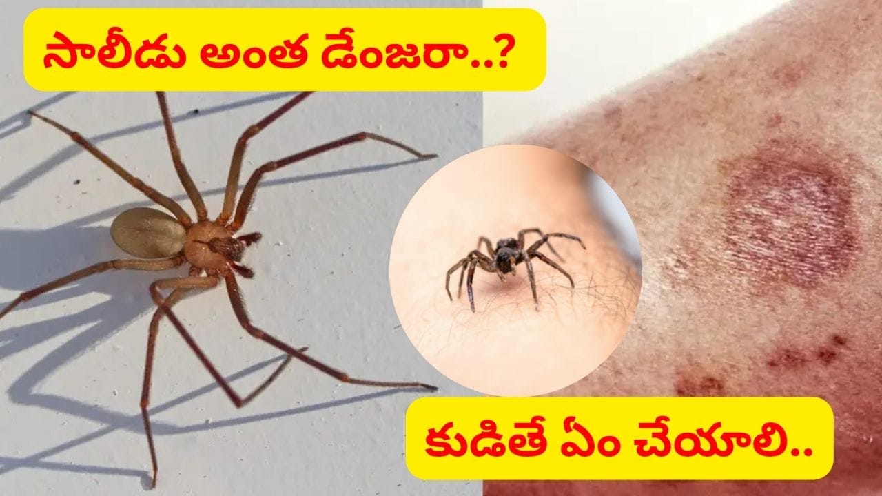 సాలె పురుగు కుట్టిన తర్వాత ఏం చేయాలి..? ఈ లక్షణాలు చాలా డేంజర్.. WHO వైద్యుడు ఏం చెప్పారంటే