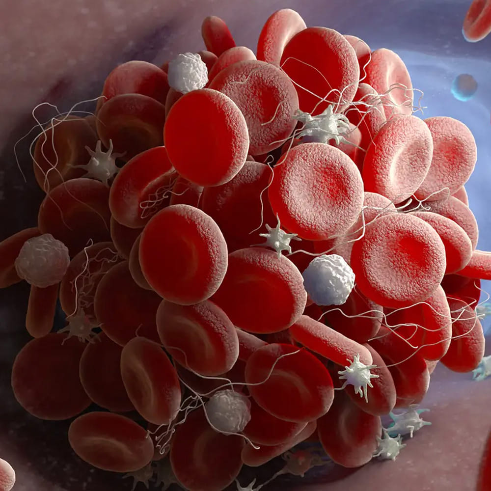 Superfoods To Increase Blood Platelets (1)