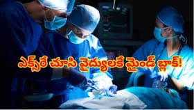 తీవ్రమైన కాలినొప్పి అని ఆస్పత్రికి వెళ్తే..ఎక్స్‌రే చూసి వైద్యులే