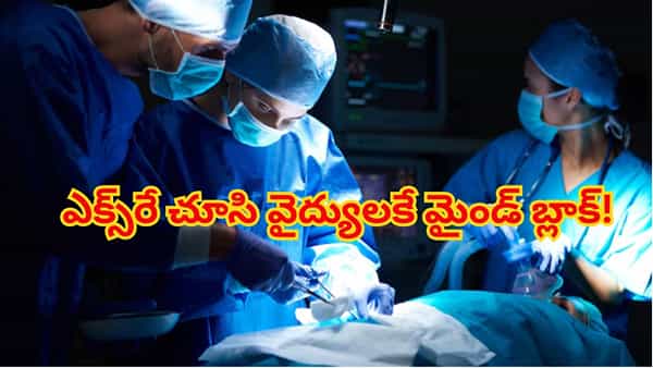 తీవ్రమైన కాలినొప్పి అని ఆస్పత్రికి వెళ్తే.. ఎక్స్రే చూసి వైద్యులకే మైండ్ బ్లాక్! కాలిలో ఏకంగా 10 పొడవాటి..