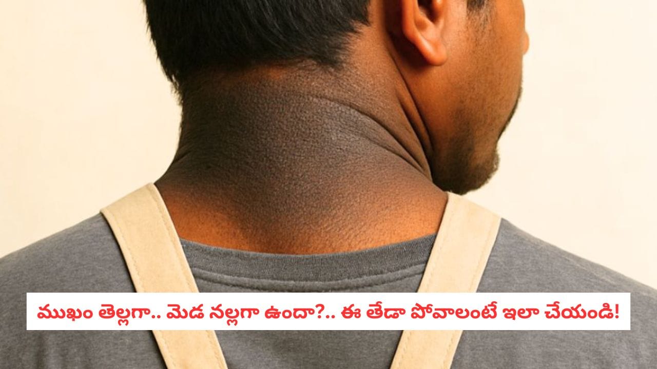 Dark Neck Remedies: ముఖం తెల్లగా.. మెడ మాత్రం నల్లగా కనిపిస్తోందా?.. ఈ సింపుల్ హోం రెమెడీస్తో క్లీన్గా ఉంచుకోవచ్చట!
