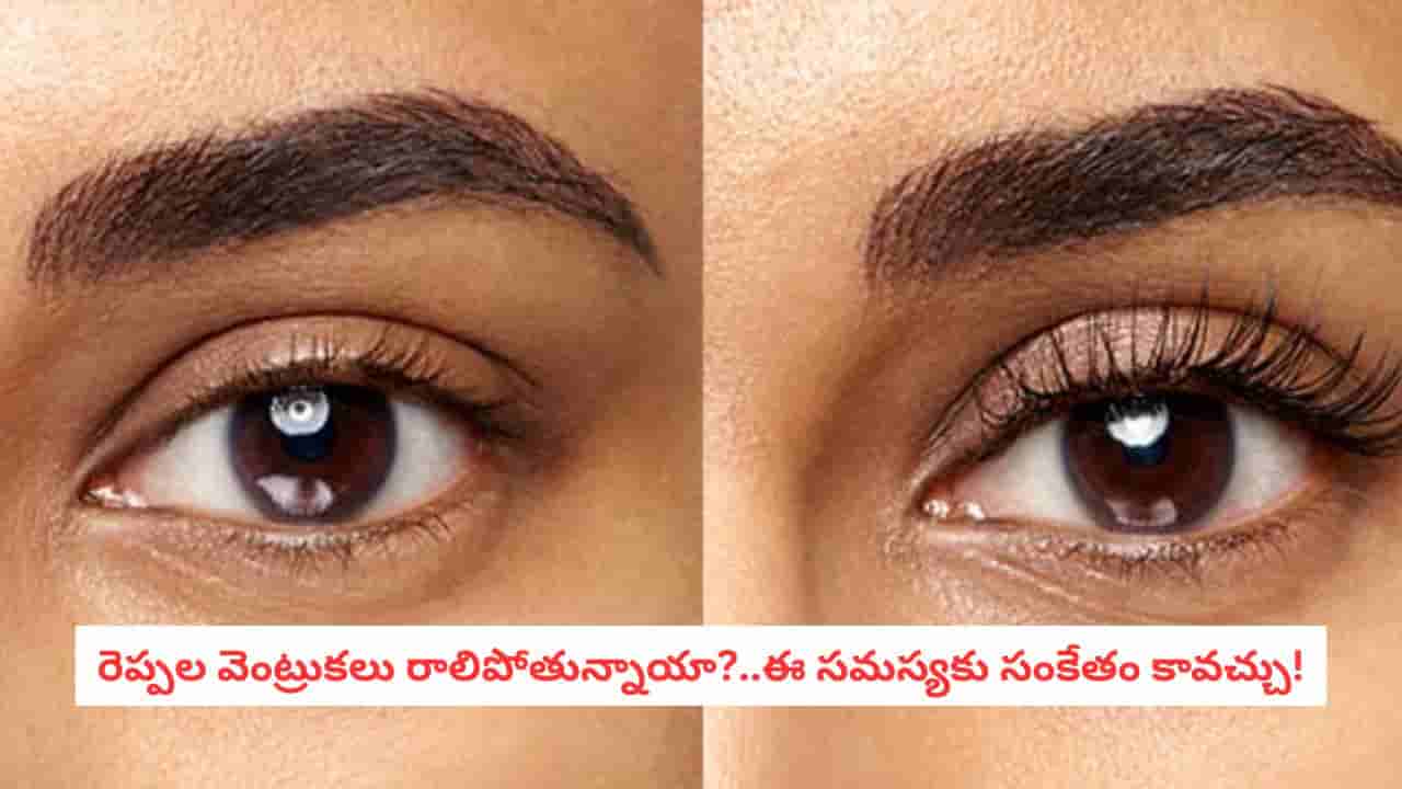 Eyelash Thinning: రెప్పల వెంట్రుకలు పలుచబడుతున్నాయా?.. నిర్లక్ష్యం చేయకండి.. ఈ కారణాలు ఉండొచ్చు!