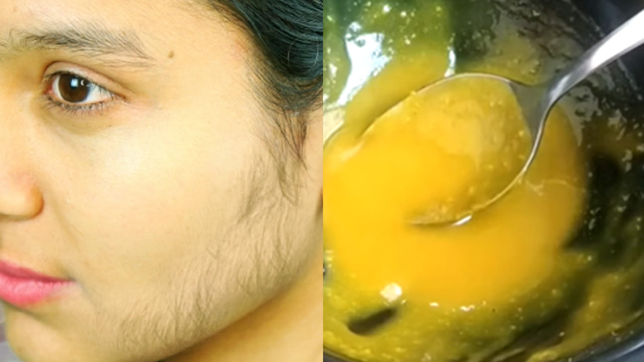 Face 1