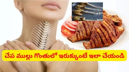 చేప ముల్లు గొంతులో ఇరుక్కుంటే వెంటనే ఇలా చేయండి.. దెబ్బకు రిలీఫ్