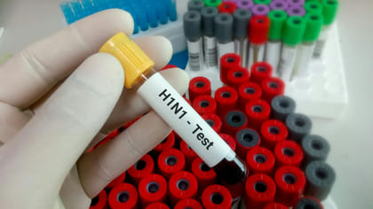 దేశంలో పెరుగుతున్న H1N1 కేసులు.. ICMR కీలక ప్రకటన