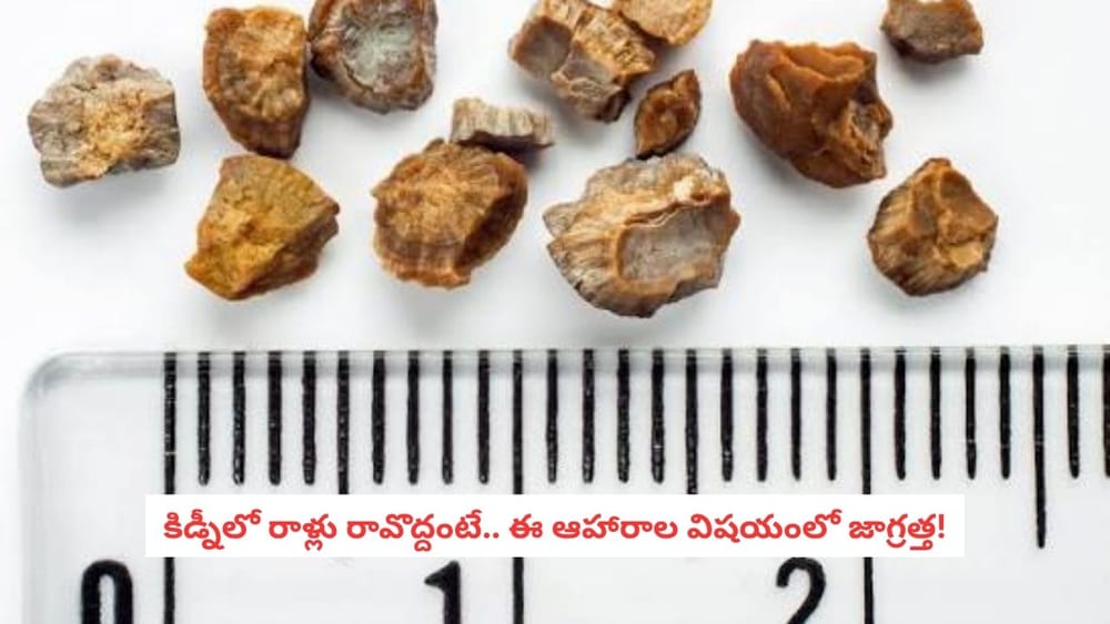 Kidney Stones: కిడ్నీలో రాళ్లు ఉన్నాయా? ఈ ఆహారాల విషయంలో మాత్రం కాస్త జాగ్రత్త!