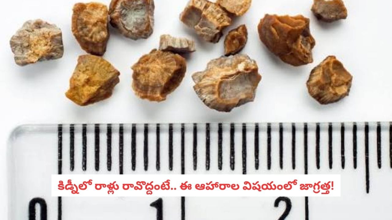 Kidney Stones: కిడ్నీలో రాళ్లు ఉన్నాయా? ఈ ఆహారాల విషయంలో మాత్రం కాస్త జాగ్రత్త!