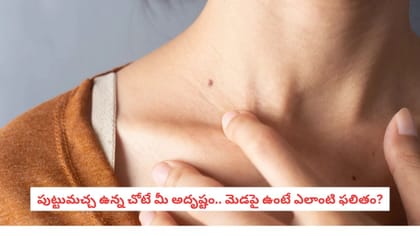 పుట్టుమచ్చ ఉన్న చోటే మీ అదృష్టం.. మెడపై ఉంటే ఎలాంటి ఫలితం?