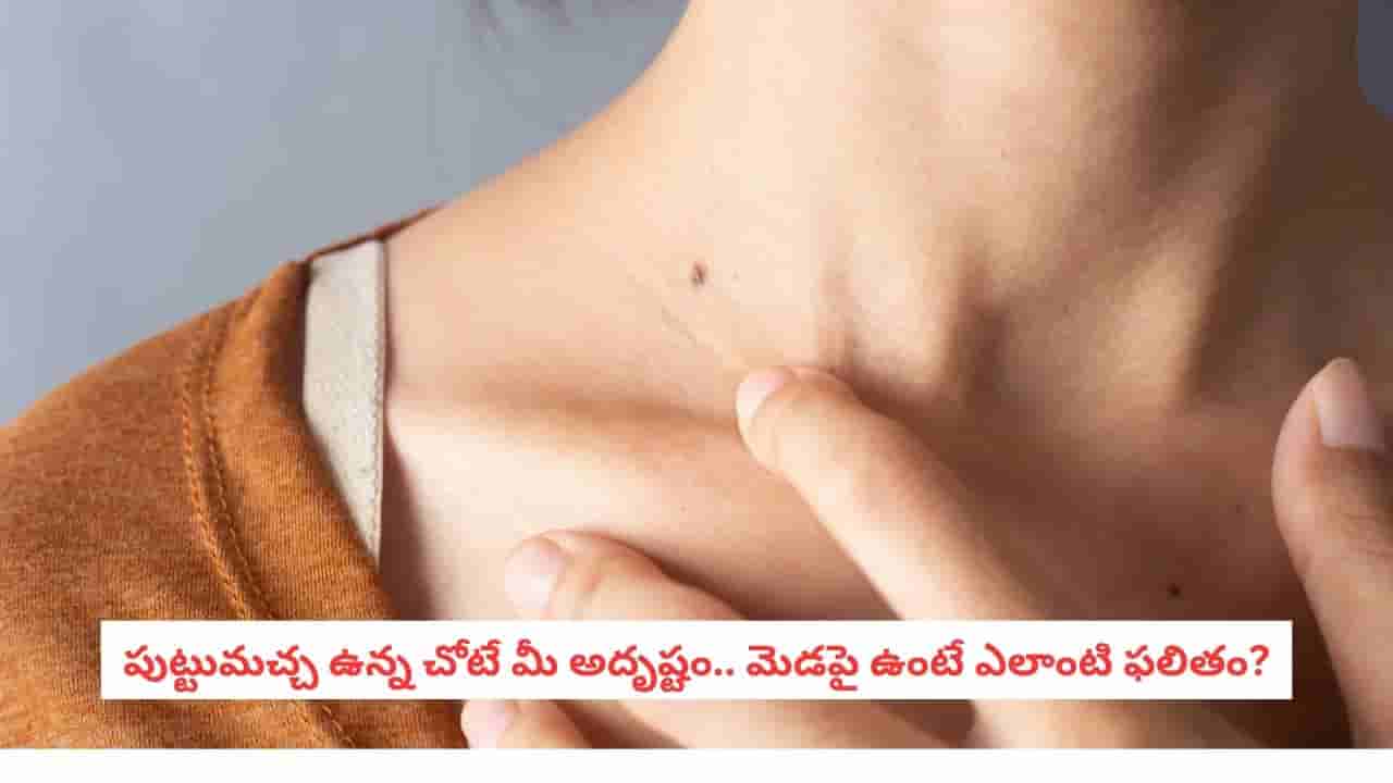 Mole on Neck: మెడపై పుట్టుమచ్చ.. మీ అదృష్టం గురించి షాకింగ్ విషయాలు!