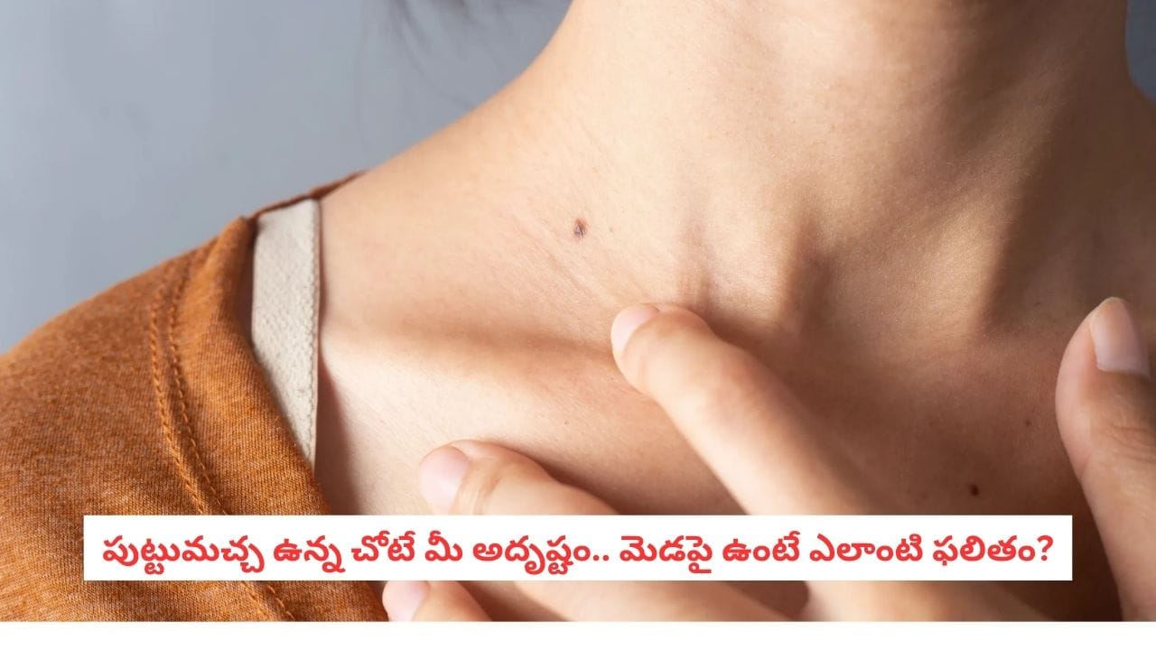 Mole on Neck: మెడపై పుట్టుమచ్చ.. మీ అదృష్టం గురించి షాకింగ్ విషయాలు!