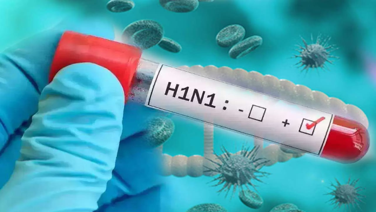 Swine Flu: ఢిల్లీ-ఎన్‌సీఆర్‌లో స్వైన్ ఫ్లూ (H1N1) కలవరం.. ప్రధాన లక్షణాలు ఇవే