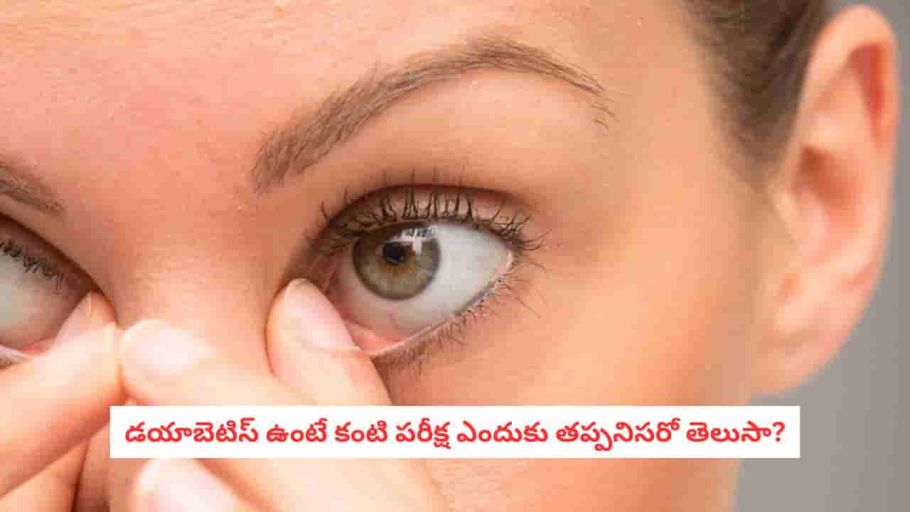 Diabetes and Eye Health: 40 దాటిన మహిళలు ఈ విషయం మర్చిపోవద్దు!.. డయాబెటిస్ ఉంటే ఈ టెస్ట్ తప్పనిసరి!