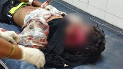యువకుడిపై యాసిడ్‌ దాడి, పరిస్థితి విషమం!