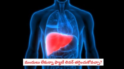 మందులు లేకున్నా ఫ్యాటీ లివర్ తగ్గించుకోవచ్చా?