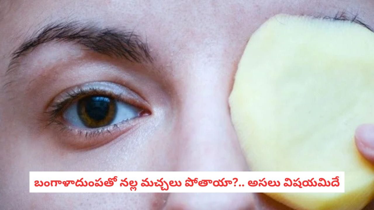 Potato for Skin: మచ్చలు, డల్ స్కిన్‌తో బాధపడుతున్నారా? బంగాళాదుంపతో ఈ బ్యూటీ టిప్స్ ట్రై చేయండి!
