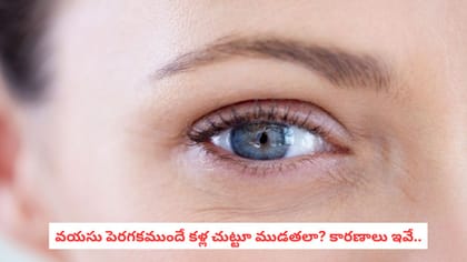 వయసు పెరగకముందే కళ్ల చుట్టూ ముడతలా? కారణాలు ఇవే..