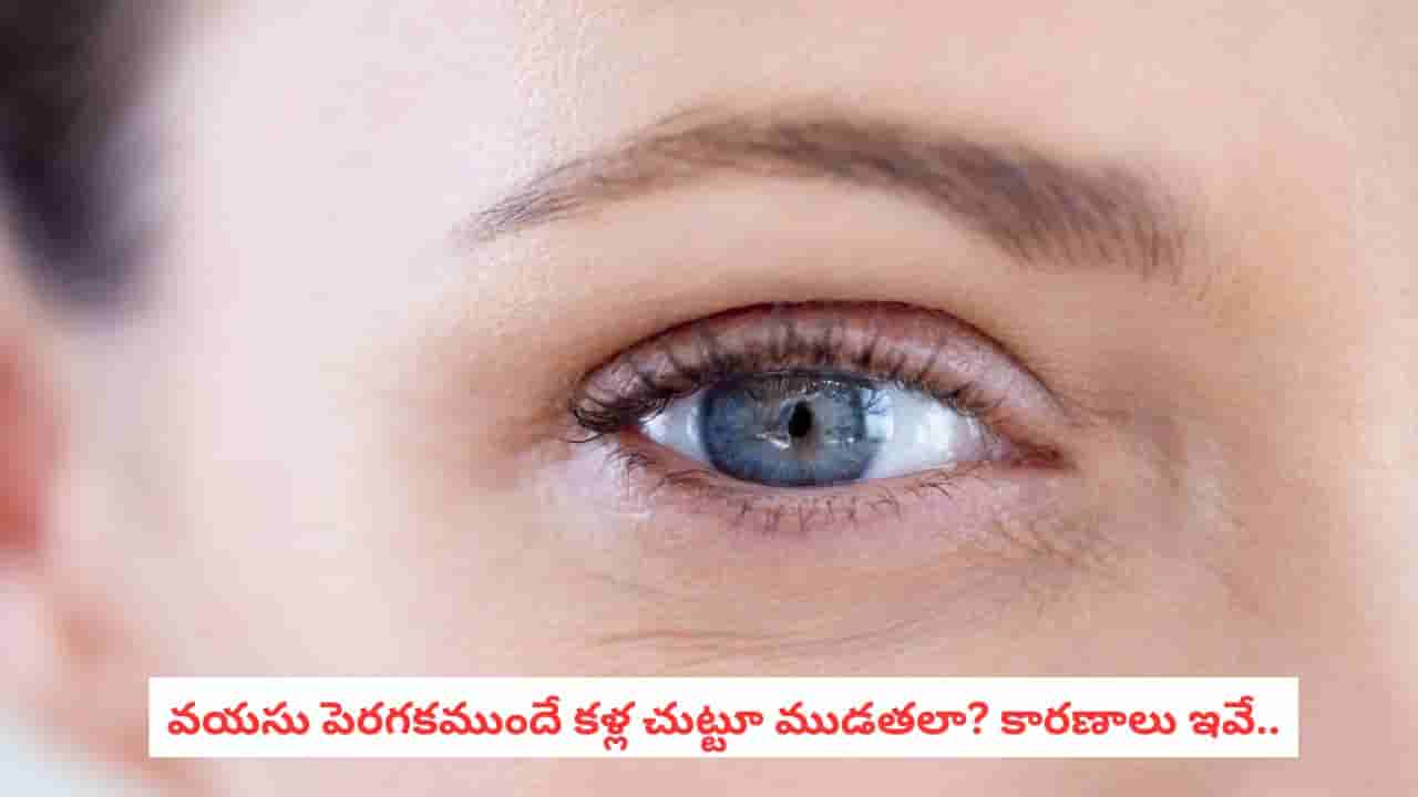 Wrinkles Around Eyes: నవ్వగానే కళ్ల పక్కన ముడతలు కనిపిస్తున్నాయా? ఇలా చేస్తే తగ్గించుకోవచ్చు!