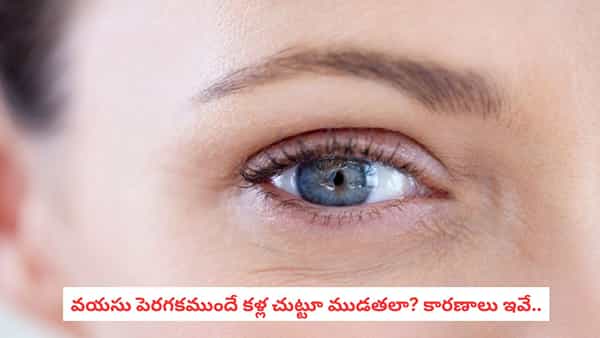 Wrinkles Around Eyes: నవ్వగానే కళ్ల పక్కన ముడతలు కనిపిస్తున్నాయా? ఇలా చేస్తే తగ్గించుకోవచ్చు!
