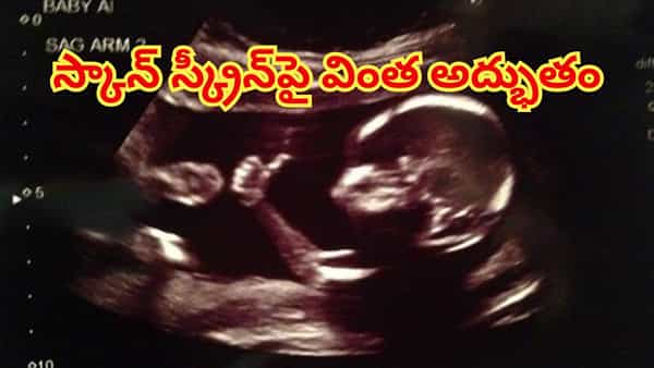 అమ్మా నేను బాగున్నాను, భయపడకు..తల్లి కడుపులో నుంచే థంబ్స్ అప్ చూపించిన పాప! కట్చేస్తే..